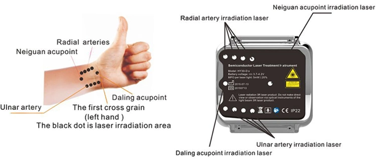 Green Treatment Low Intensity Laser Therapy Device with CE